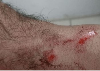 Pacientes torturados são resgatados em clínica terapêutica no Sul de Minas