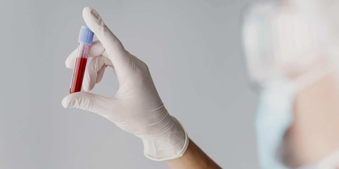 Atendimentos no CTA/SAE/UDM serão interrompidos por dois dias em Poços