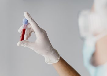 Atendimentos no CTA/SAE/UDM serão interrompidos por dois dias em Poços