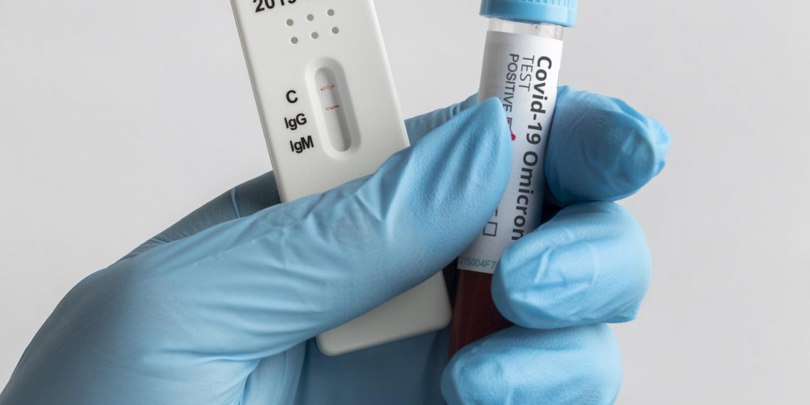 Saúde orienta farmácias sobre testes para HIV, sífilis e hepatites