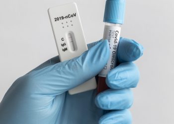 Saúde orienta farmácias sobre testes para HIV, sífilis e hepatites