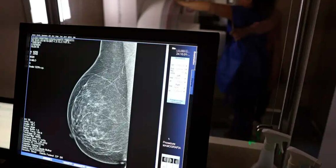 Mulheres de baixa renda terão exames gratuitos de câncer de mama