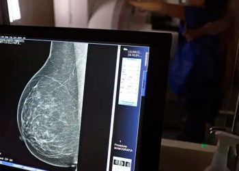 Mulheres de baixa renda terão exames gratuitos de câncer de mama