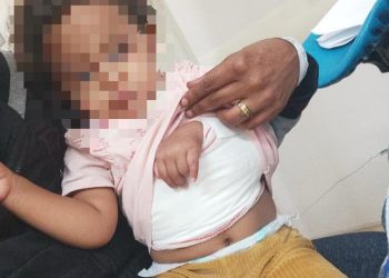 Bebê fratura clavícula e família aciona a polícia contra creche em Poços de Caldas