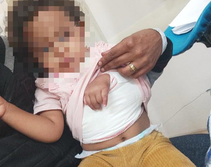 Bebê fratura clavícula e família aciona a polícia contra creche em Poços de Caldas