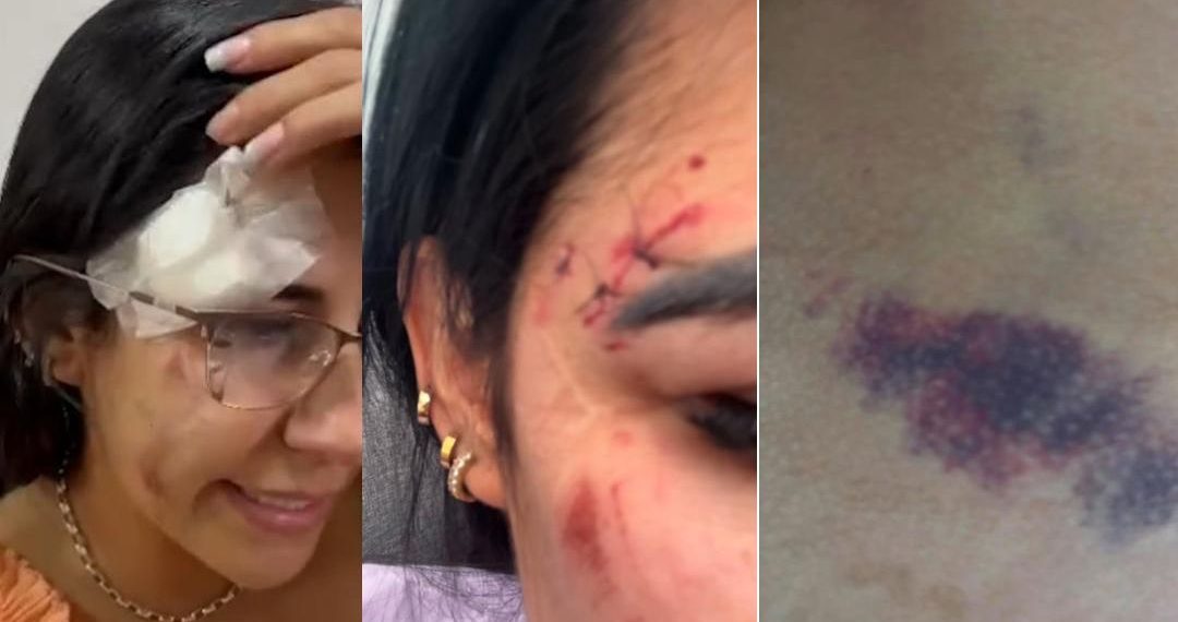 VÍDEO: mulher denuncia agressão sofrida pelo namorado em Poços de Caldas