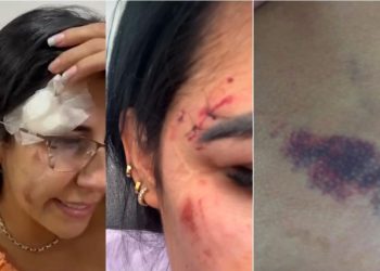 VÍDEO: mulher denuncia agressão sofrida pelo namorado em Poços de Caldas