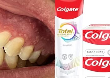 Colgate Total Clean Mint tem interdição suspensa pela Anvisa e volta a ser vendido