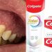 Colgate Total Clean Mint tem interdição suspensa pela Anvisa e volta a ser vendido