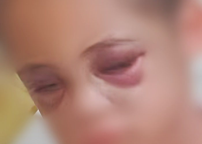 Polícia Civil investiga caso de criança hospitalizada com suspeita de agressão em Poços