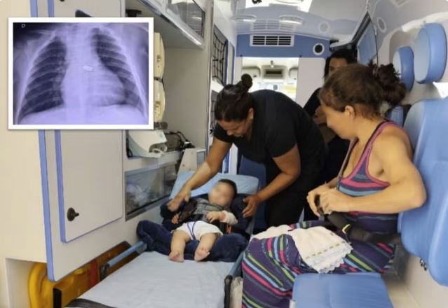 Bebê de 9 meses é transferido de Alfenas para BH para retirar brinquedo que se alojou no pulmão