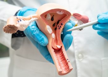 SUS vai substituir papanicolau por exame mais sensível ainda este ano