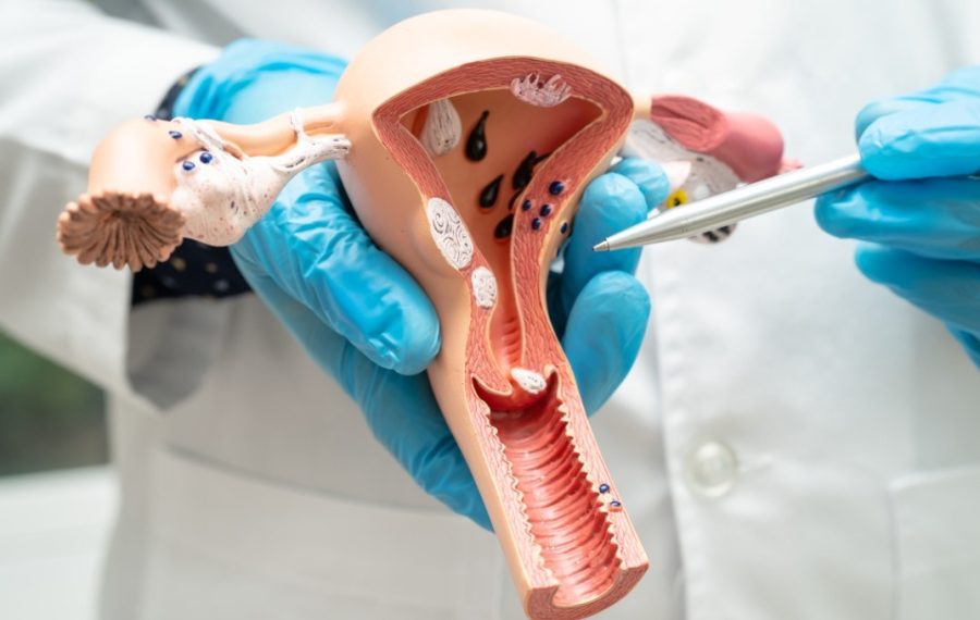 SUS vai substituir papanicolau por exame mais sensível ainda este ano