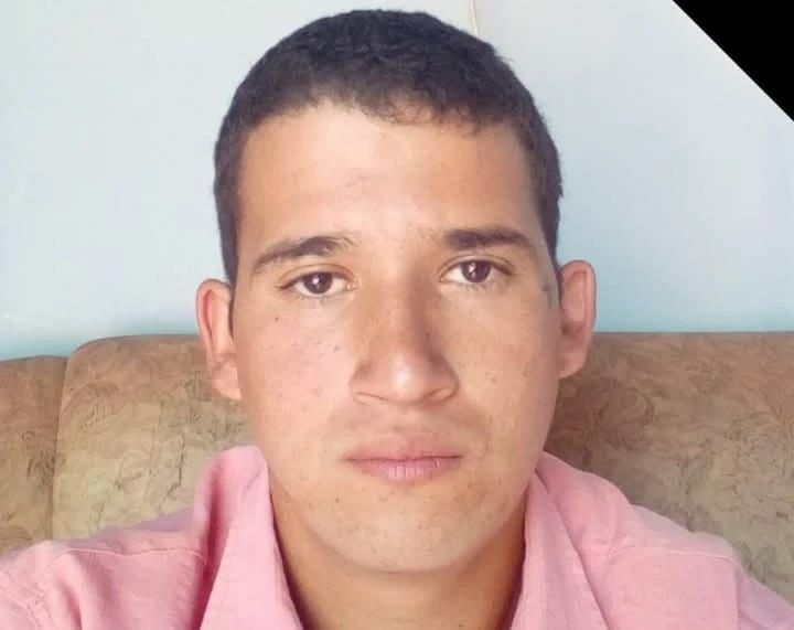 Jovem que sofreu queimaduras ao tentar apagar fogo em casa morre em Poços de Caldas