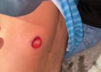 Confrontos com PM em Poços têm registros de feridos e prisão por embriaguez ao volante