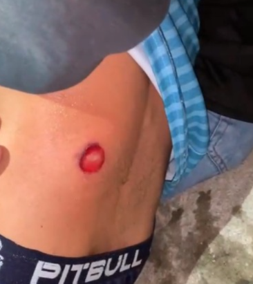 Confrontos com PM em Poços têm registros de feridos e prisão por embriaguez ao volante