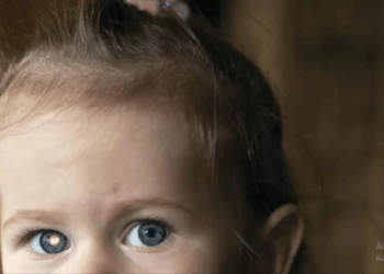 Campanha nacional “De Olho nos Olhinhos” chega a Poços de Caldas