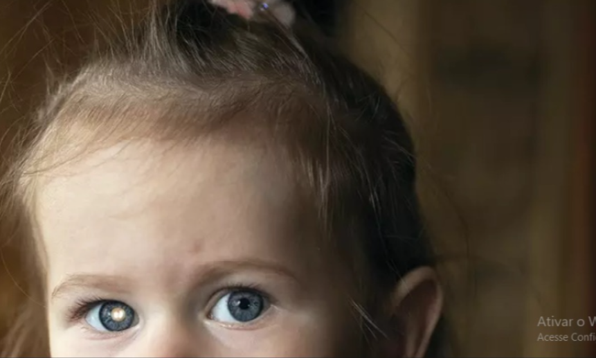 Campanha nacional “De Olho nos Olhinhos” chega a Poços de Caldas