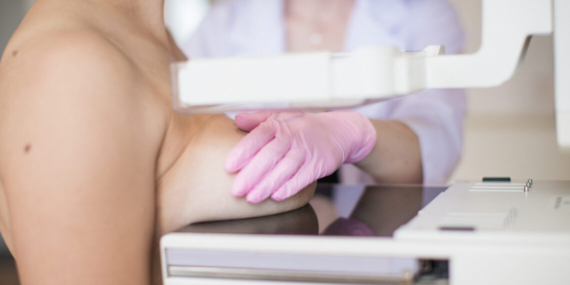 Sancionada lei que institui mutirão anual de mamografias gratuitas em Poços
