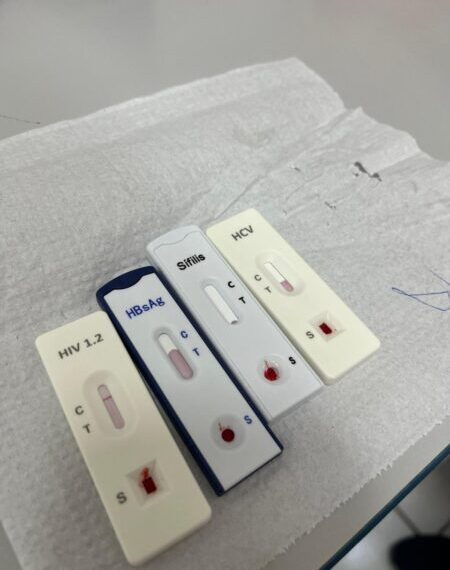 Poços de Caldas registra queda nos casos de sífilis