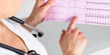 Prefeitura de Poços realiza mutirão com mais de 4 mil exames cardiológicos