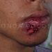 Jovem diz que levou tiro de borracha na boca e acusa PM de tentar mudar versão