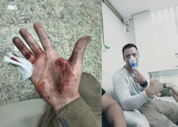 Criança que estava em casa incendiada em Poços, foi salva por PM que se rastejou e inalou fumaça para socorrê-la