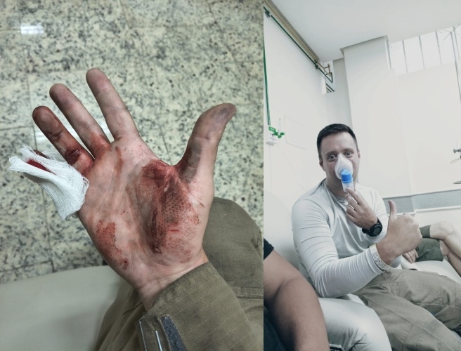 Criança que estava em casa incendiada em Poços, foi salva por PM que se rastejou e inalou fumaça para socorrê-la