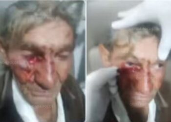 Idoso é agredido por vizinho em Poços de Caldas; Polícia Civil investiga o caso