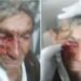Idoso é agredido por vizinho em Poços de Caldas; Polícia Civil investiga o caso