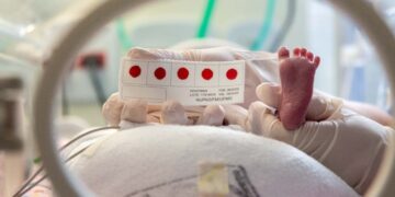 Minas Gerais é o primeiro estado do país a rastrear gratuitamente 64 doenças no Teste do Pezinho