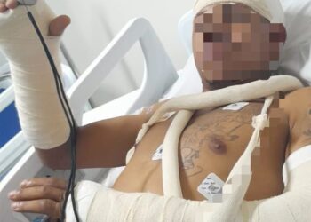 Homem baleado três vezes pelo irmão em Poços apresenta versão; caso é investigado