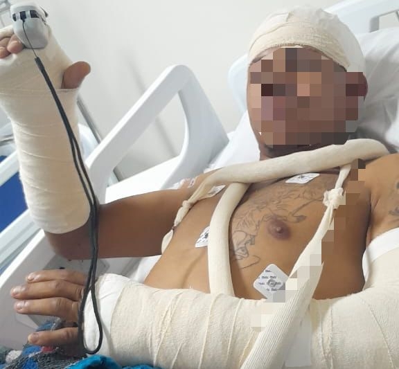 Homem baleado três vezes pelo irmão em Poços apresenta versão; caso é investigado