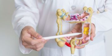 Anvisa aprova novo medicamento para pacientes com câncer colorretal metastático