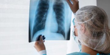 SUS terá três novos medicamentos para tratamento de câncer de pulmão