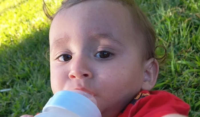 Criança de 1 ano e meio aguarda cirurgia há meses em Poços de Caldas e família faz vaquinha
