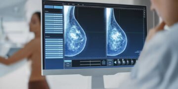 Planos de saúde terão que cobrir mamografia digital sem limite de idade