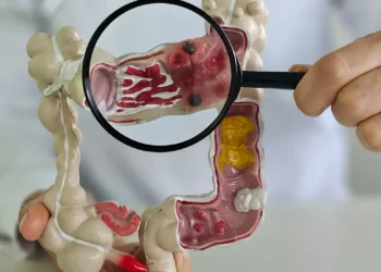 Casos de doenças inflamatórias intestinais crescem cinco vezes no Brasil