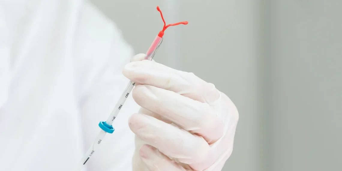 Planos de saúde terão que cobrir DIU hormonal para endometriose