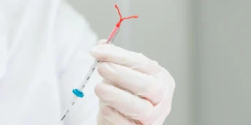 Planos de saúde terão que cobrir DIU hormonal para endometriose