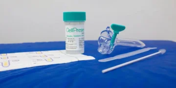 SUS registra quase 10 mil testes positivos para HPV de alto risco