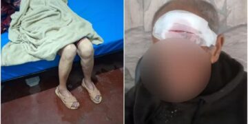 Polícia Civil investiga denúncias de maus-tratos a idosos em instituição de Poços